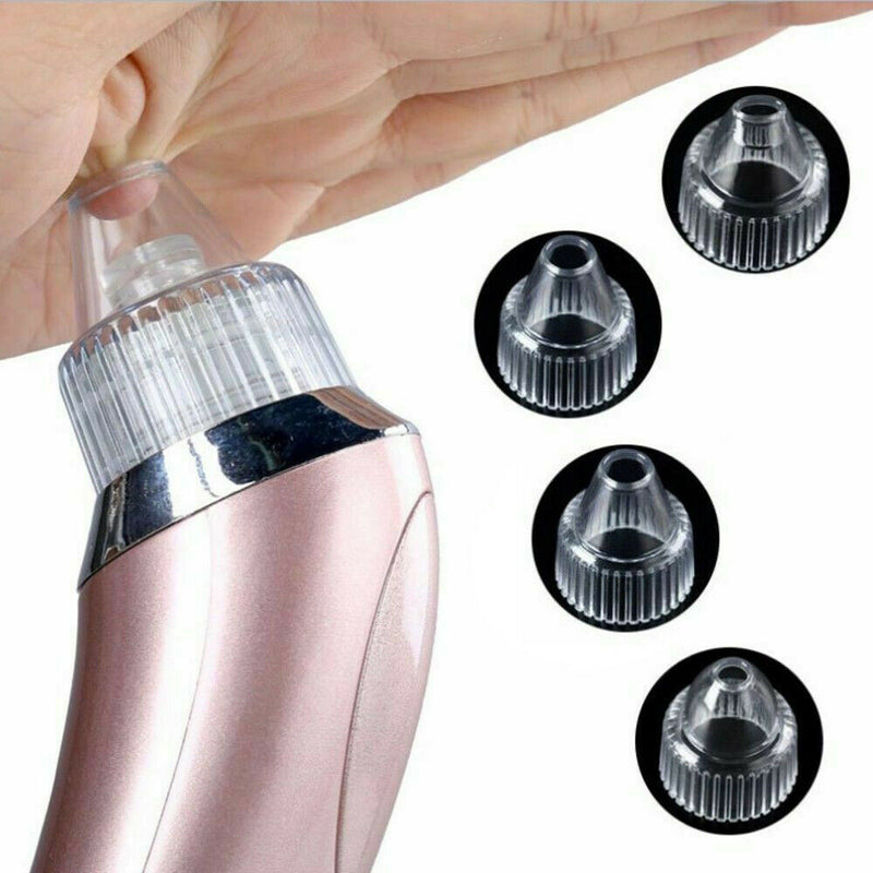 Blackhead Remover Vacuum Acne Cleaner Black Spots Removal